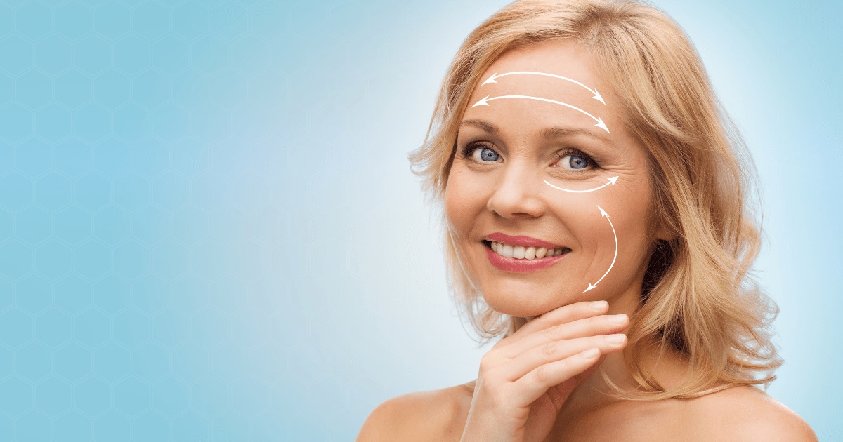 Mini Facelift in Vietnam: Subtle Lifting with Natural Results 4 Mini Facelift in Vietnam 2