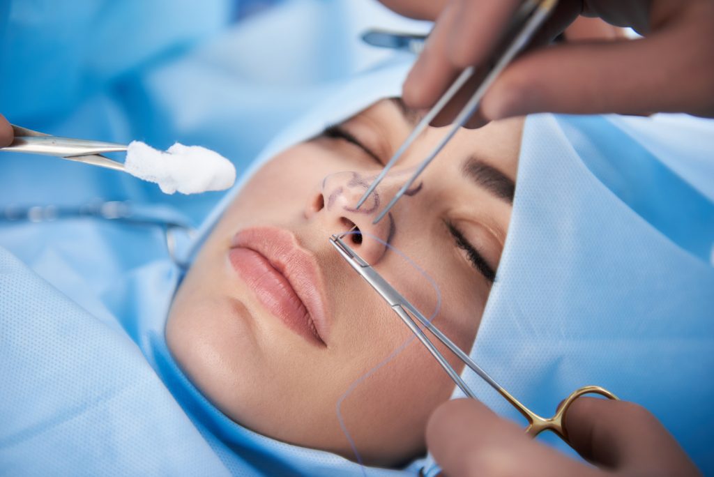 Rhinoplasty in vietnam 6