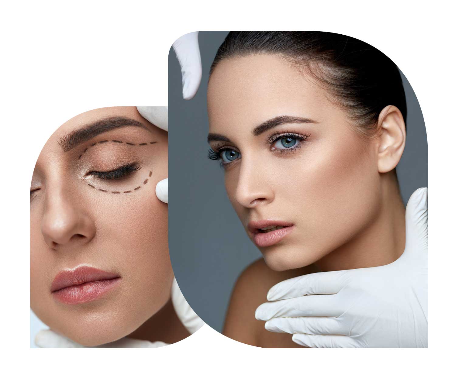 Scar Revision Surgery in Vietnam: Improve Scar Appearance Effectively 3 Scar Revision Surgery in Vietnam: Improve Scar Appearance Effectively