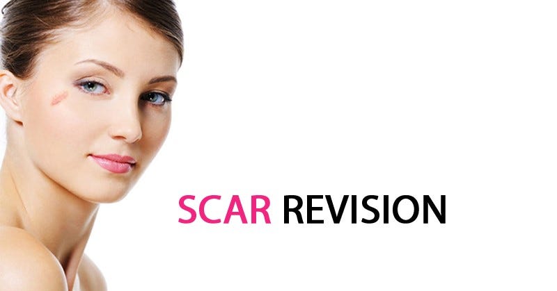 Scar Revision Surgery in Vietnam: Improve Scar Appearance Effectively 6 Scar Revision Surgery in Vietnam 4