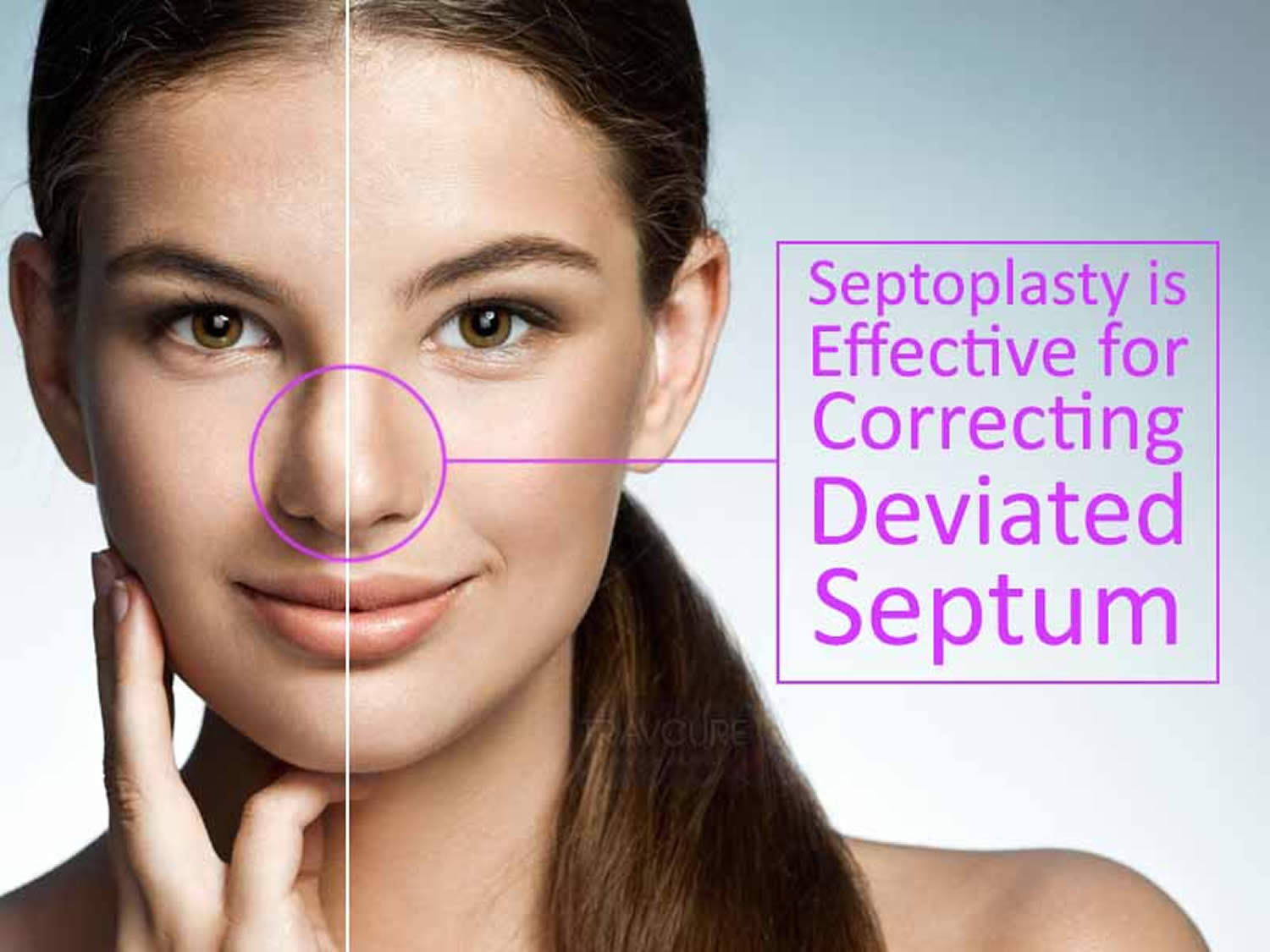 Septoplasty in Vietnam: Improve Breathing and Nasal Function 3 Septoplasty in Vietnam: Improve Breathing and Nasal Function