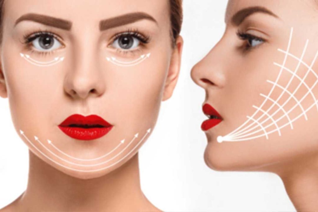 V Line Chin Contouring in vietnam 1