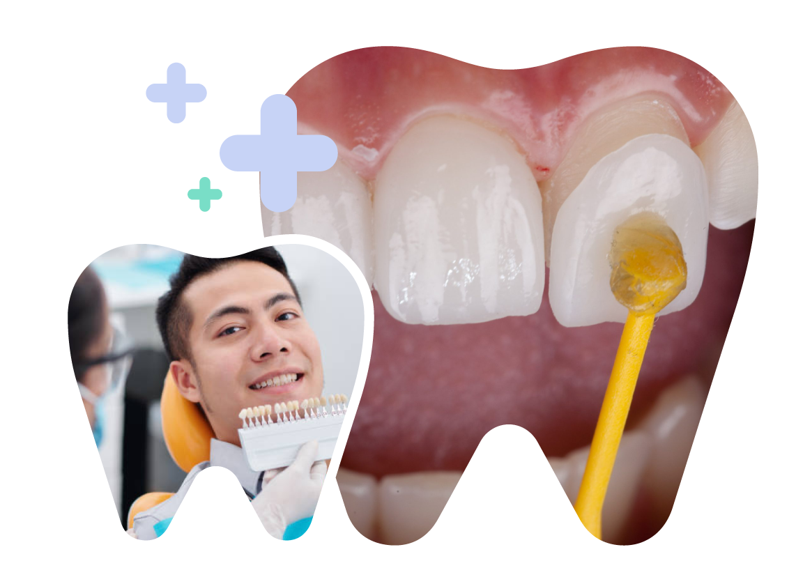 Prominent Front Teeth in Vietnam. Prominent Front Teeth in Vietnam. Prominent Front Teeth in Vietnam. Prominent Front Teeth in Vietnam