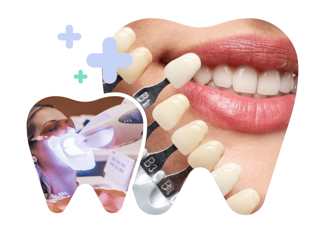 Poor-Quality Porcelain Crowns in Vietnam. Poor-Quality Porcelain Crowns in Vietnam. Poor-Quality Porcelain Crowns in Vietnam