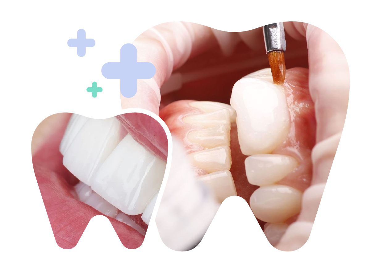 Orthodontics in Vietnam. Orthodontics in Vietnam. Orthodontics in Vietnam