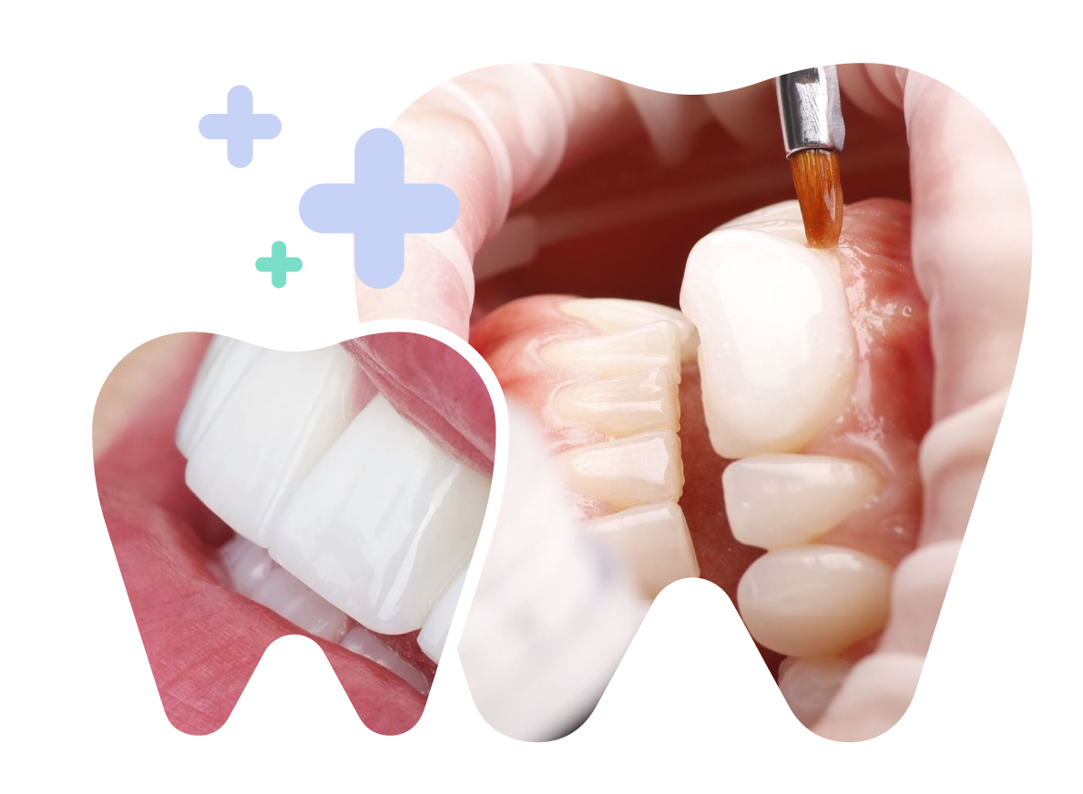 Prominent Front Teeth in Vietnam. Prominent Front Teeth in Vietnam. Prominent Front Teeth in Vietnam