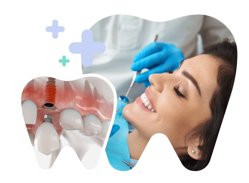 Ý nghĩa phong thủy của răng nanh ở người