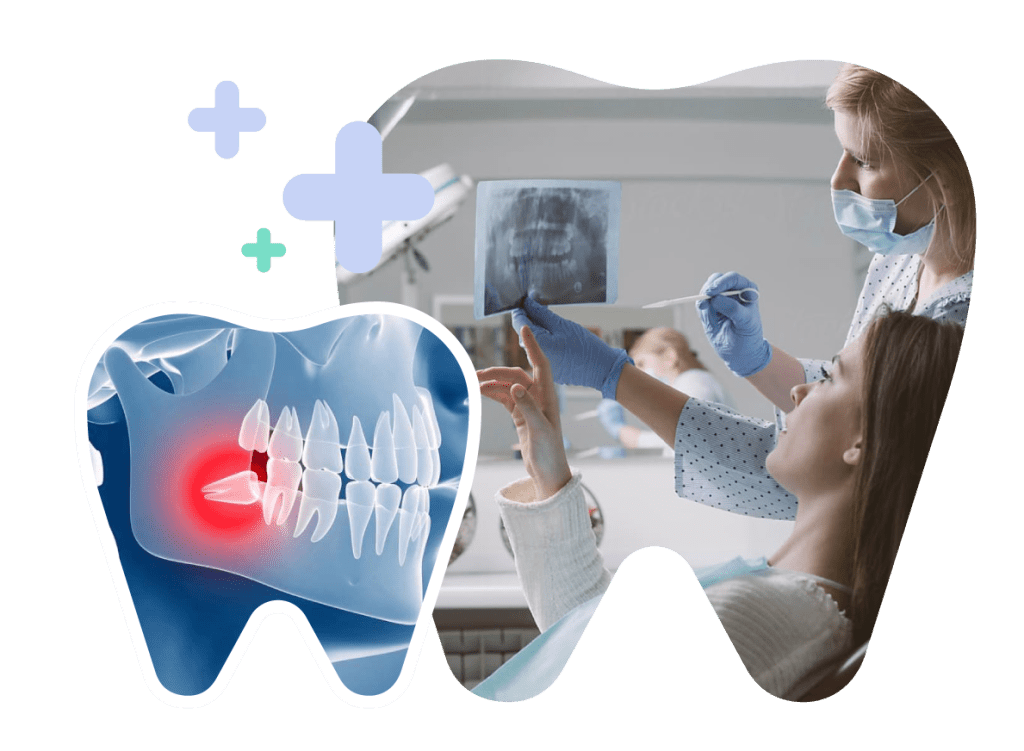 Tooth Extraction Before Braces in Vietnam