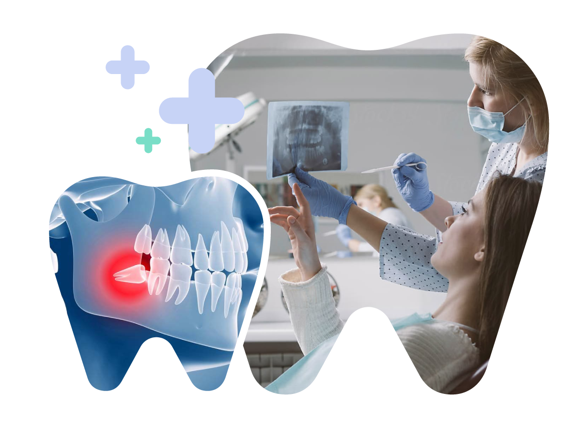 Tooth Extraction Before Braces in Vietnam