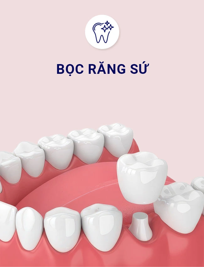 boc rang s