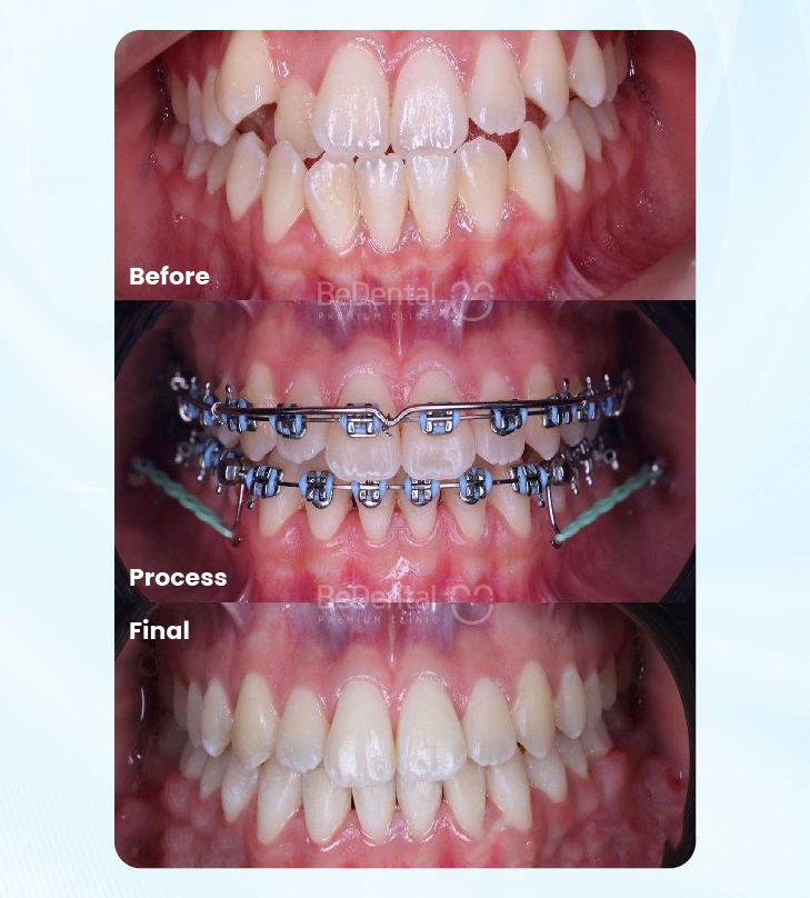 Orthodontics