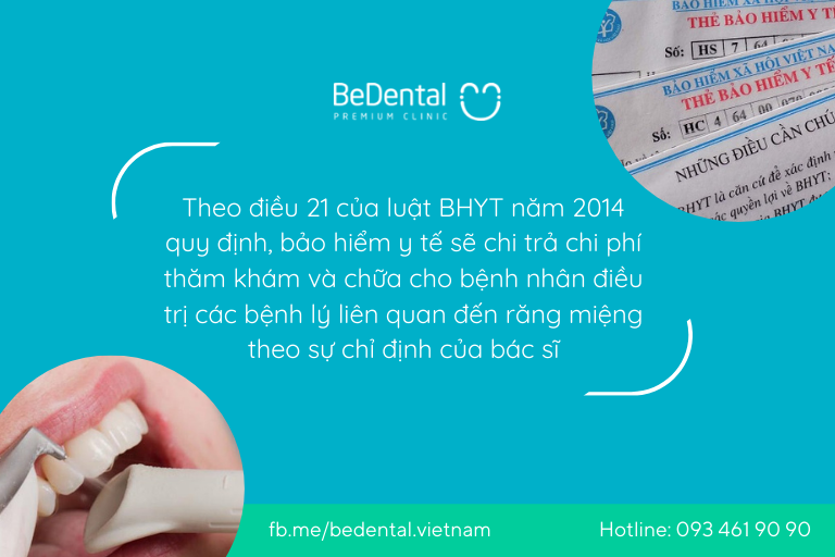 lấy cao răng có được bảo hiểm y tế chi trả không