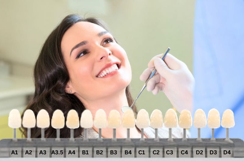 How Long Do Porcelain Crowns Last in Vietnam? Durability, Care, and What to Expect 5 Why Vietnam Is a Leading Destination for Porcelain Crowns
