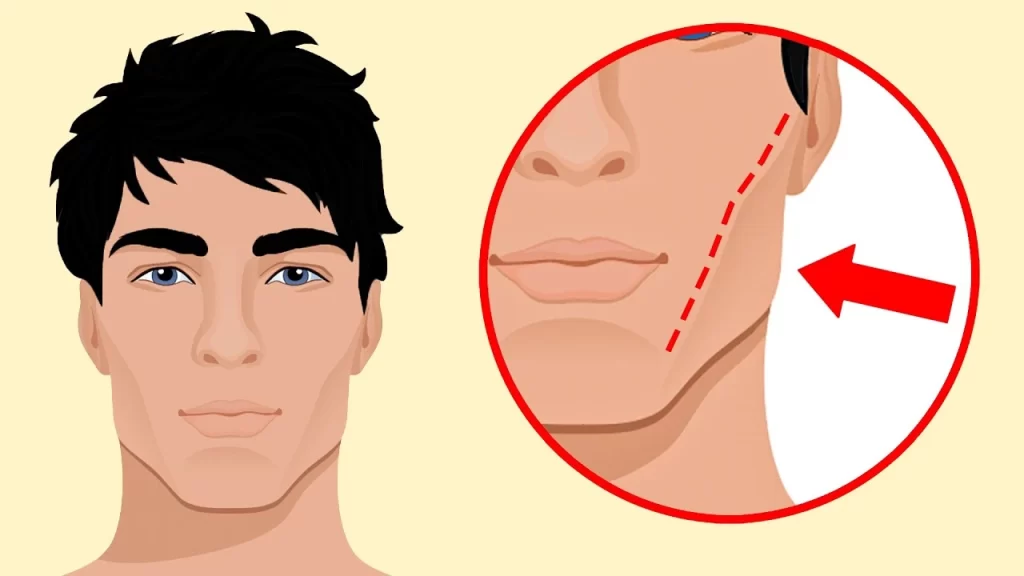 Temporomandibular Joint Inflammation in Vietnam: Causes, Symptoms, and Treatment Options 6 Facial Hollowing from Braces in Vietnam. Facial Hollowing from Braces in Vietnam. Facial Hollowing from Braces in Vietnam