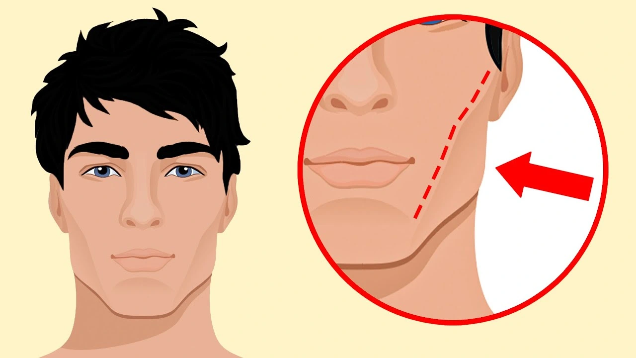 Can Patients with a Crossbite Practice Mewing in Vietnam?