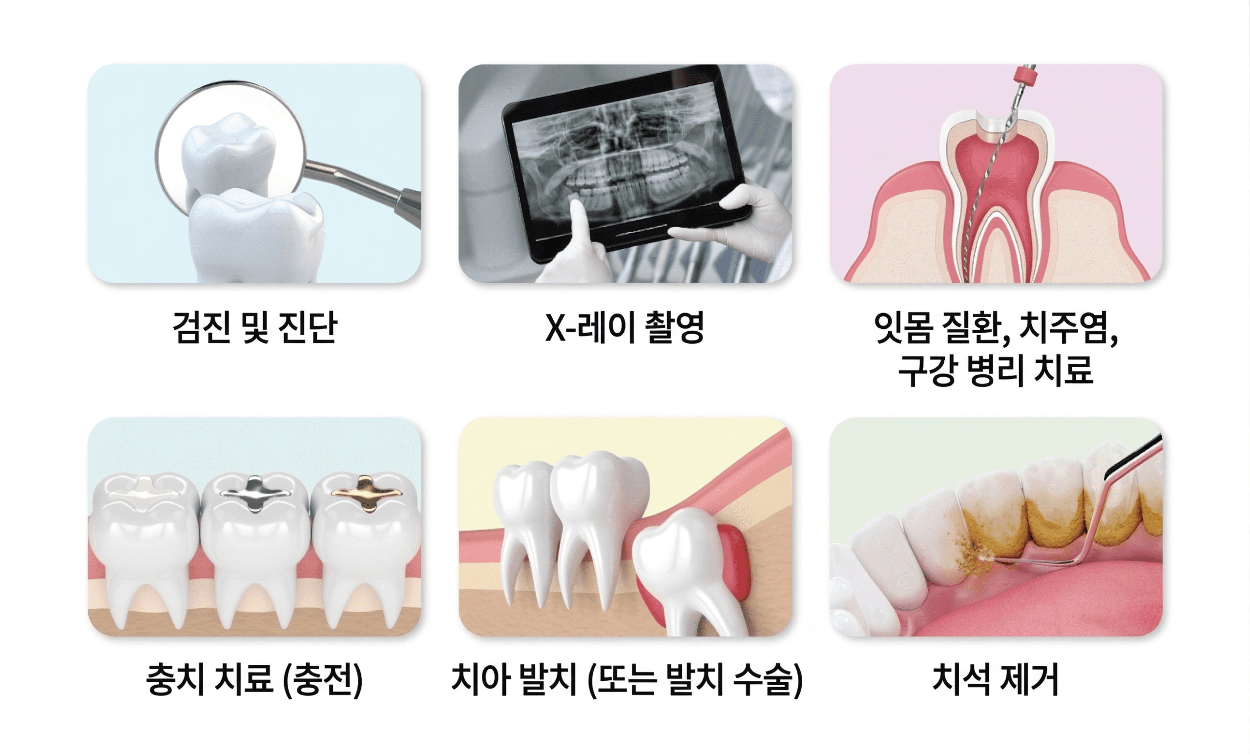 보험 보증 5 Gemini Generated Image m85u2km85u2km85u scaled