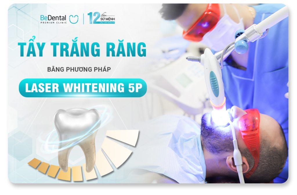 Tẩy Trắng Răng Chuyên Nghiệp: Có Hại Không, Bao Lâu Và Bao Nhiêu Tiền? 1 tẩy trắng răng chuyên nghiệp tại phòng khám