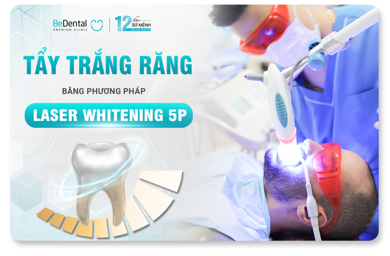 Tẩy Trắng Răng Chuyên Nghiệp: Có Hại Không, Bao Lâu Và Bao Nhiêu Tiền? 5 tẩy trắng răng chuyên nghiệp tại phòng khám