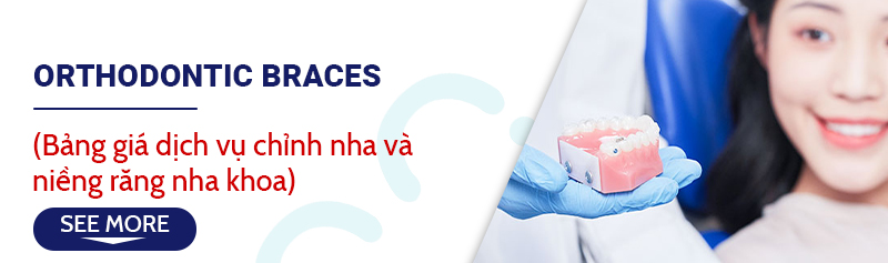 giá niềng răng bedental 2026