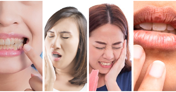 Mụn Và Sức Khỏe Răng Miệng: Mối Liên Hệ Khoa Học Và Cách Chăm Sóc Đúng 6 mụn và sức khỏe răng miệng có liên quan đến nhau