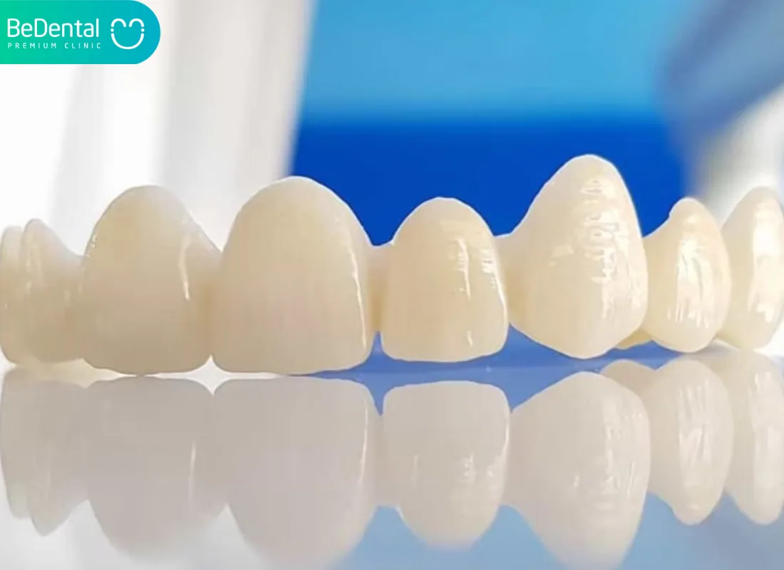 Should Children Get Porcelain Crowns in Vietnam
