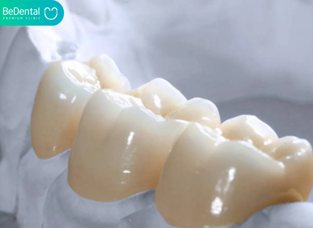 Should Children Get Porcelain Crowns in Vietnam