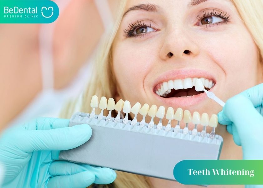 teeth whitening vietnam