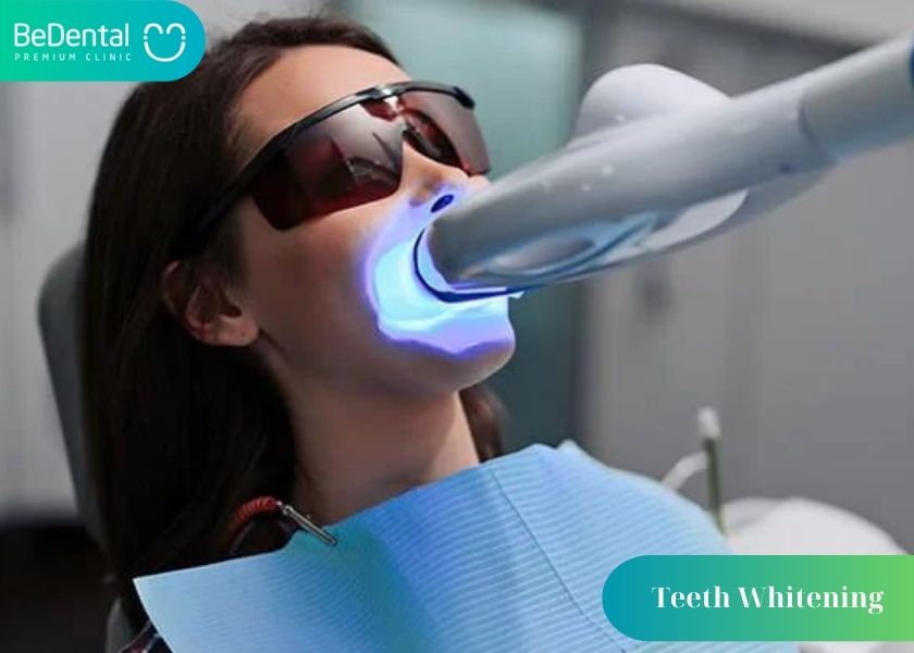 teeth whitening vietnam