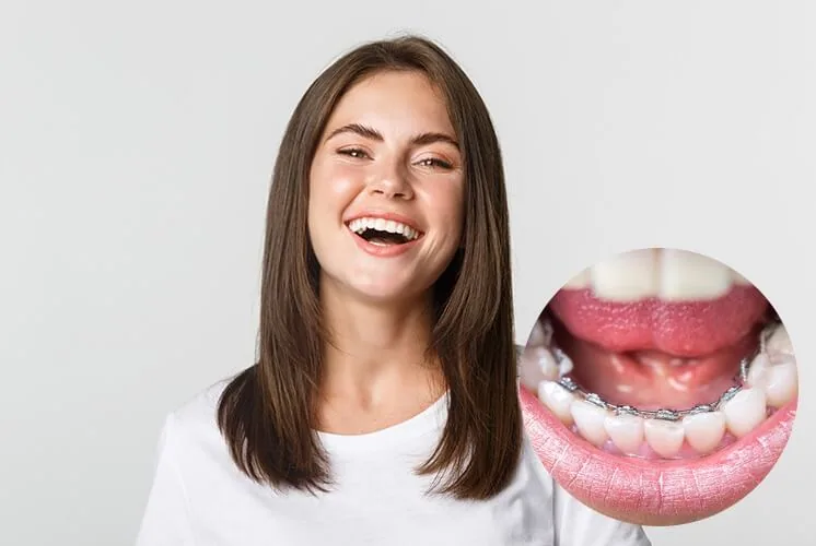 Loose Teeth During Braces in Vietnam. Loose Teeth During Braces in Vietnam. Loose Teeth During Braces in Vietnam