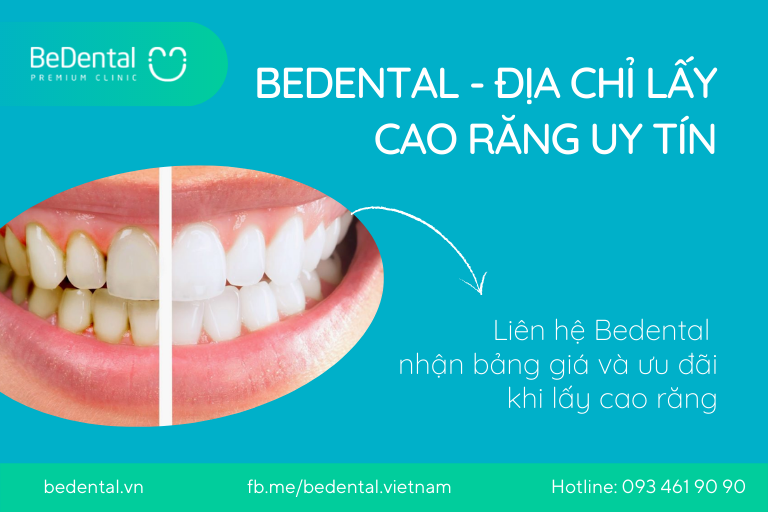 trải nghiệm cạo vôi răng lấy cao răng lần đầu tiên