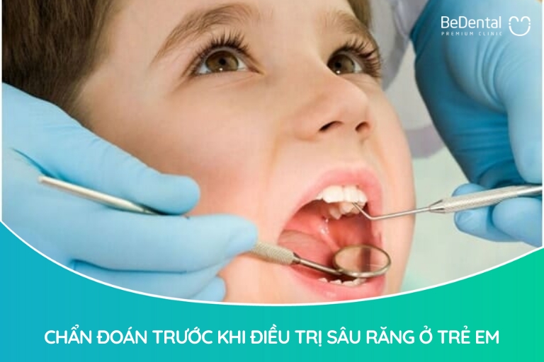 sâu răng nguyên nhân do chế độ sinh hoạt sai cách