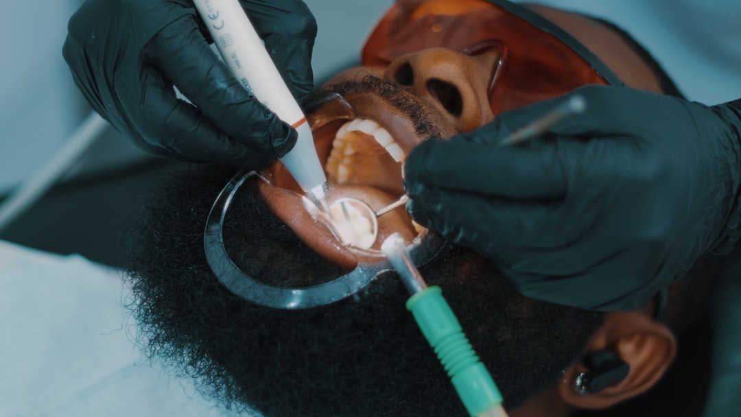 Tooth extraction at BeDental Vietnam