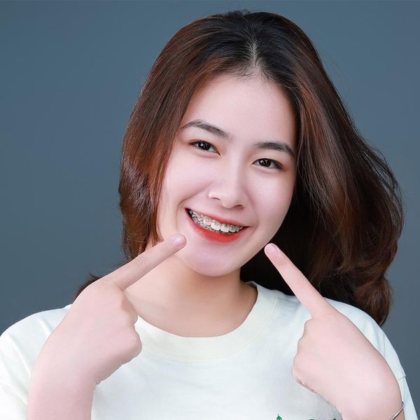 Niềng Răng Cho Người Lớn: 30, 40, 50 Tuổi Có Niềng Được Không? 5 người lớn tuổi có nên niềng răng không