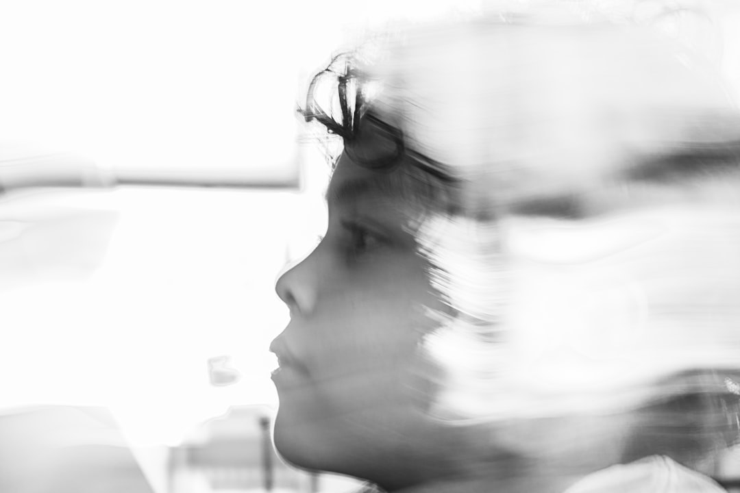 Painless extraction at BeDental Vietnam