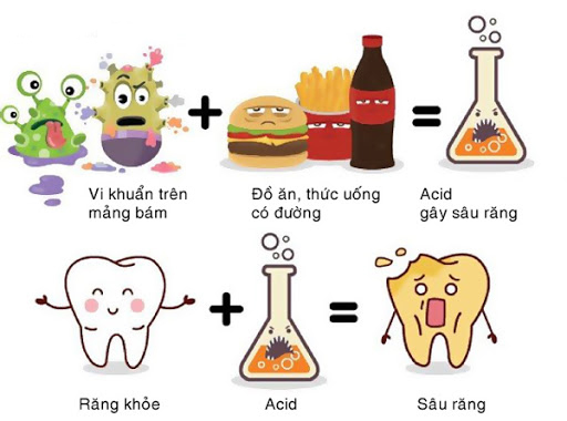 sâu răng nguyên nhân do chế độ sinh hoạt sai cách