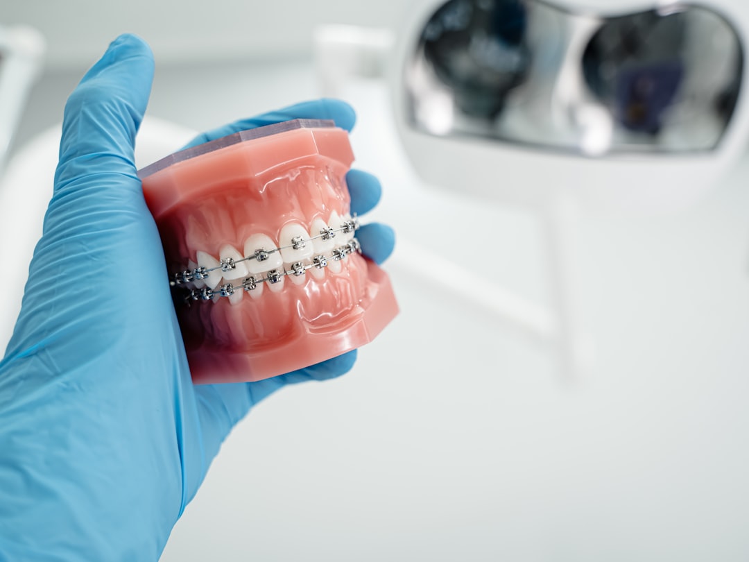 Buck teeth treatment at BeDental Vietnam