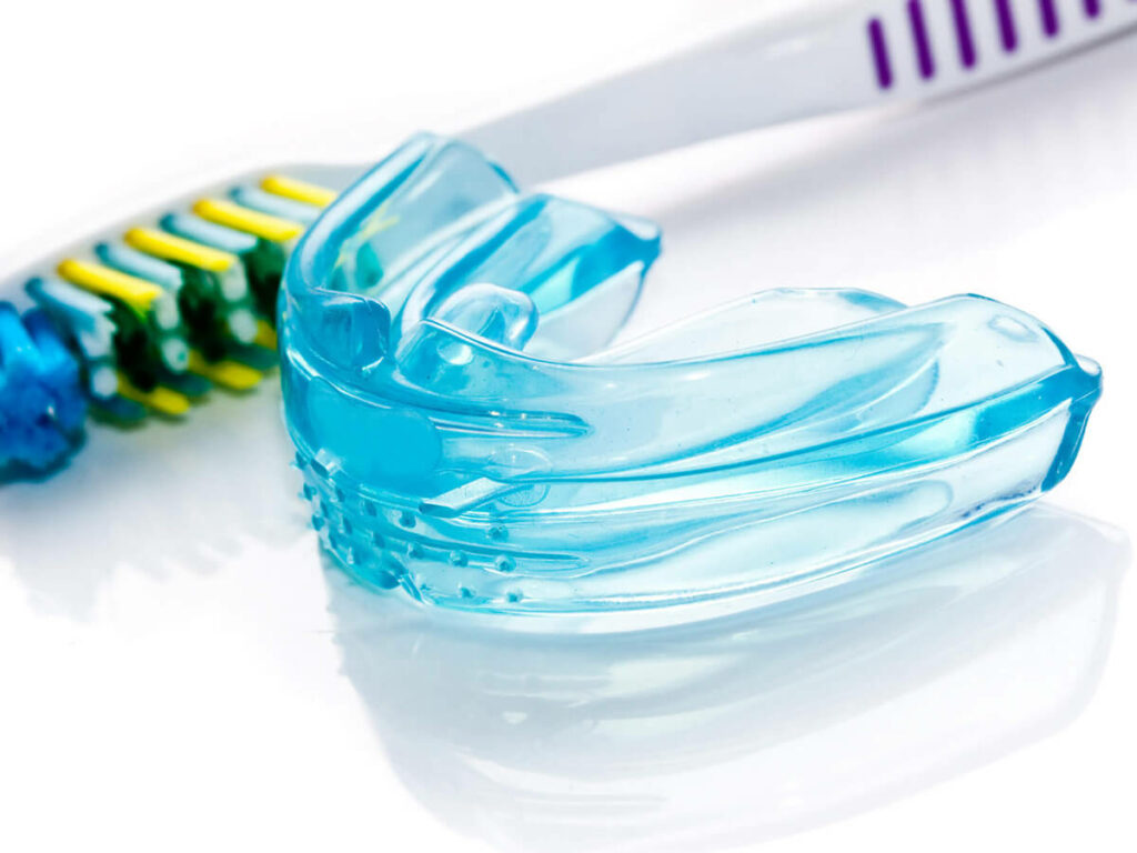 mouth guards dental service 1024x768 1